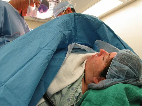 WHAT DOES A DAD OR BIRTH PARTNER DO DURING A C-SECTION? - Purely